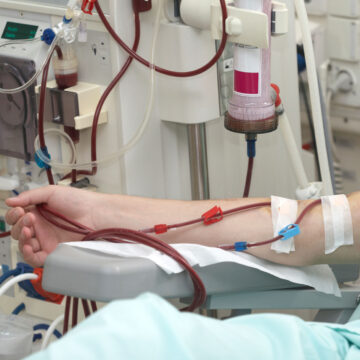 Dialysis go cheaper in Tanzania, the government announces 