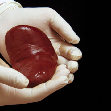 A woman dies after being forced to donate her Kidney to her boss’s relative in Saudi Arabia.